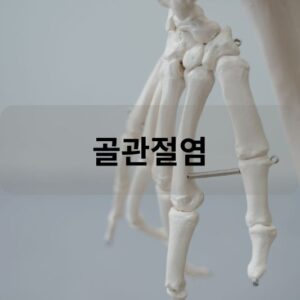 골관절염