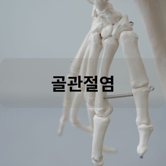 골관절염: 원인, 증상, 치료 방법 알아보기!