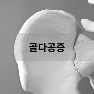 골다공증