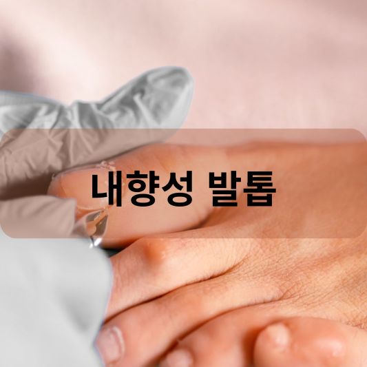 내향성 발톱: 원인, 증상, 치료 방법 알아보기!
