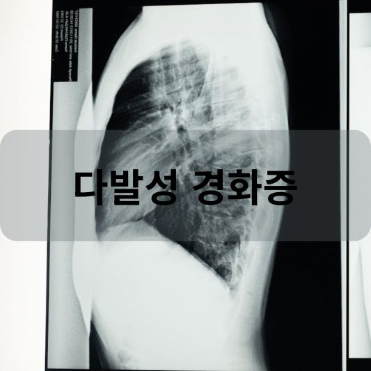 다발성 경화증: 원인, 증상, 치료 방법 알아보기!