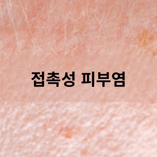 접촉성 피부염: 원인, 증상, 치료 방법 알아보기!