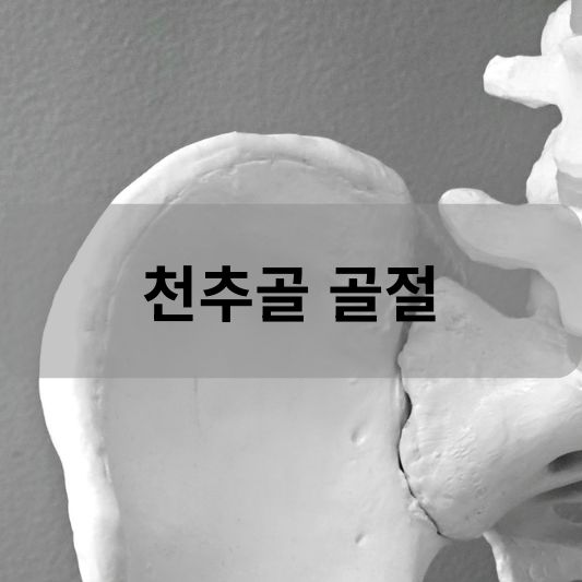 천추골 골절: 원인, 증상, 치료 방법 알아보기!