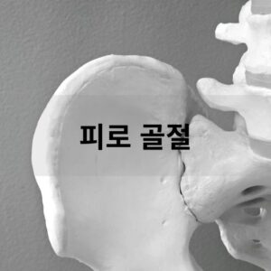 피로 골절