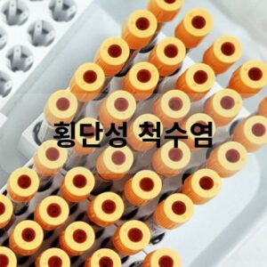 횡단성 척수염