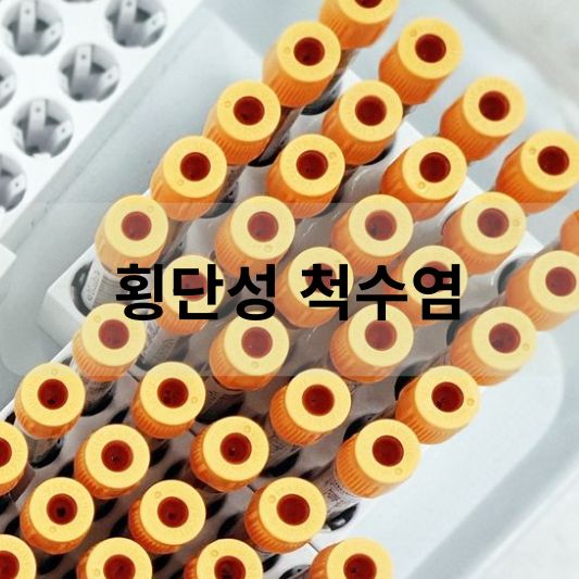 횡단성 척수염: 원인, 증상, 치료 방법 알아보기!