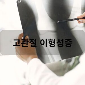 고관절 이형성증