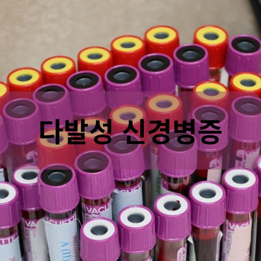 다발성 신경병증: 원인, 증상, 치료 방법 알아보기!