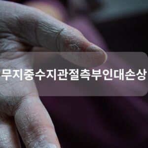 무지중수지관절측부인대손상