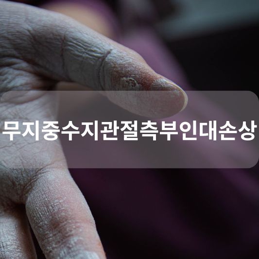 무지중수지관절측부인대손상: 원인, 증상, 치료 방법 알아보기!