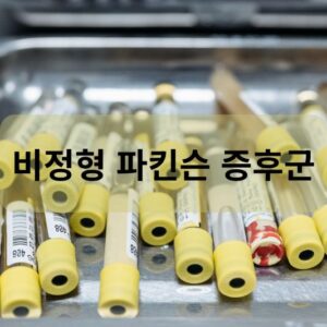 비정형 파킨슨 증후군