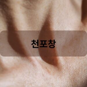 천포창