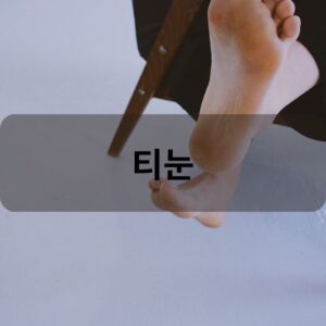 티눈