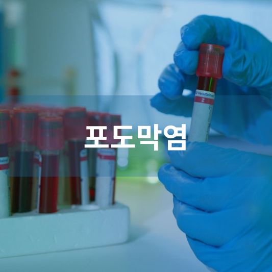 포도막염: 원인, 증상, 치료 방법 알아보기!