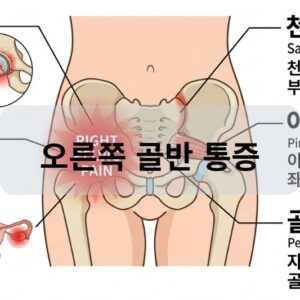 오른쪽 골반 통증