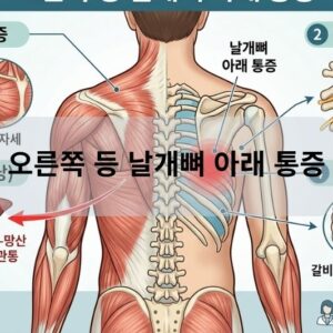 오른쪽 등 날개뼈 아래 통증