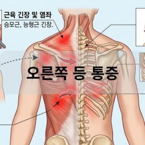 오른쪽 등 통증