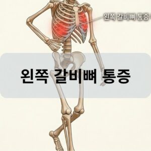 왼쪽 갈비뼈 통증