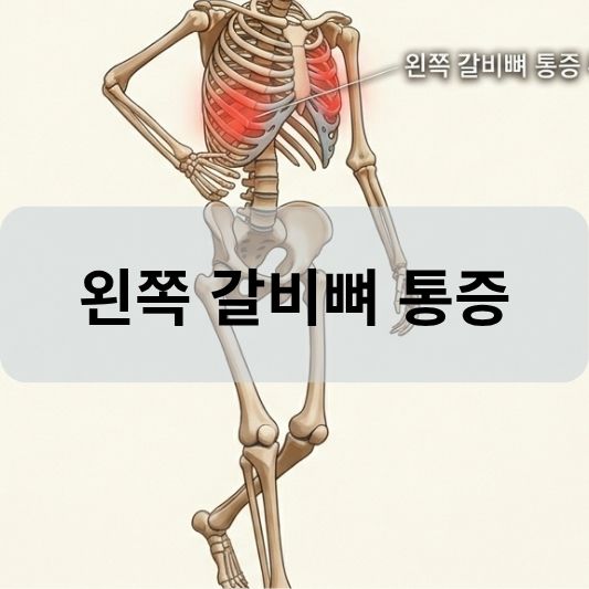 왼쪽 갈비뼈 통증: 원인, 증상, 치료 방법 알아보기!