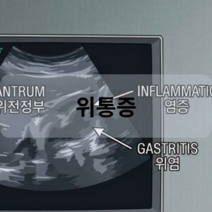 위통증