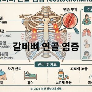 갈비뼈 연골 염증