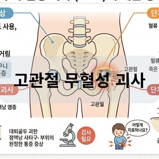 고관절 무혈성 괴사: 원인, 증상, 치료 방법 알아보기!