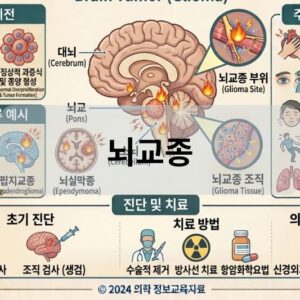 뇌교종