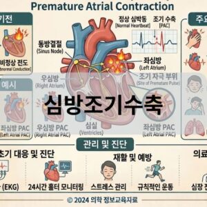 심방조기수축