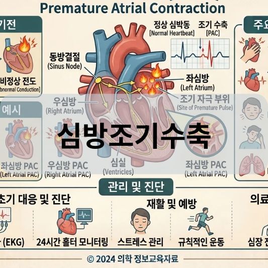 심방조기수축: 원인, 증상, 치료 방법 알아보기!