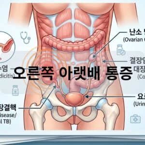 오른쪽 아랫배 통증